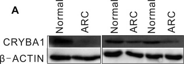 CRYBA1 Antibody