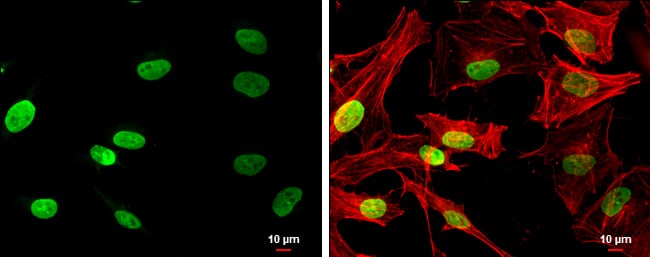 NSD3 Antibody