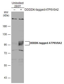 ATP6V0A2 Antibody