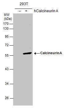 Calcineurin A Antibody