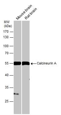 Calcineurin A Antibody