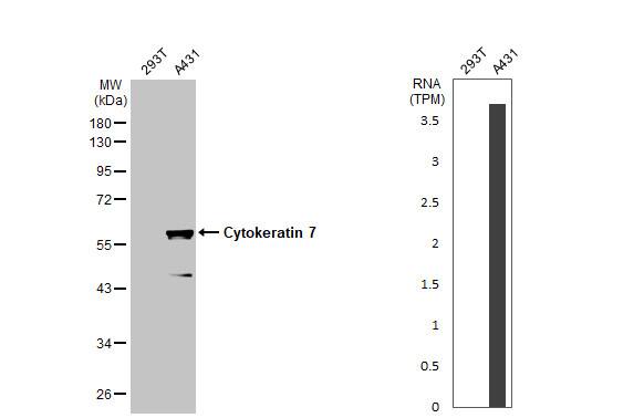 Cytokeratin 7 Antibody
