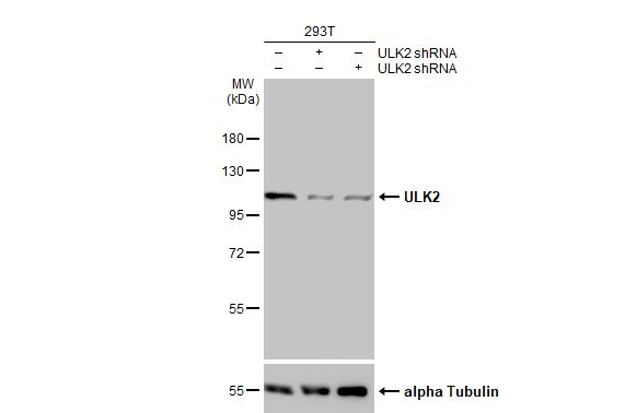 ULK2 Antibody