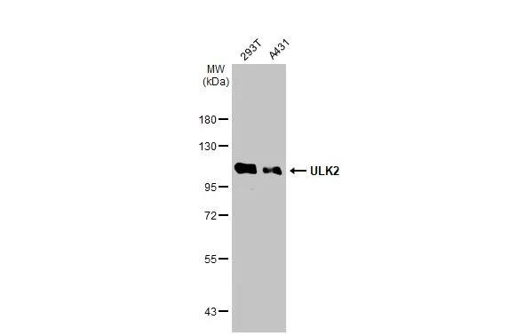 ULK2 Antibody
