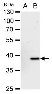 Chitinase 3-like 2 Antibody