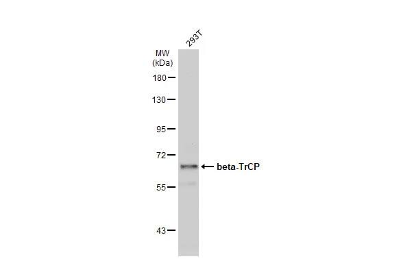 beta-TrCP1/BTRC Antibody