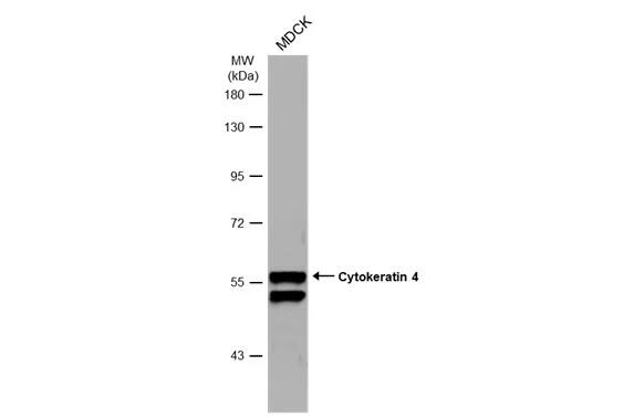 Cytokeratin 4 Antibody