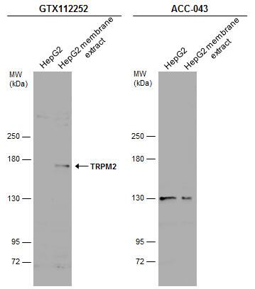 TRPM2 Antibody - BSA Free