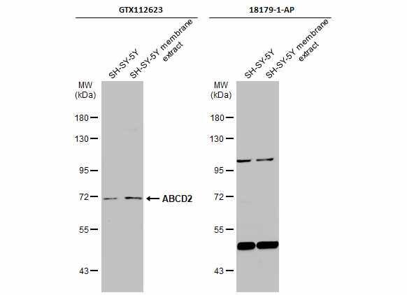 ABCD2 Antibody - BSA Free