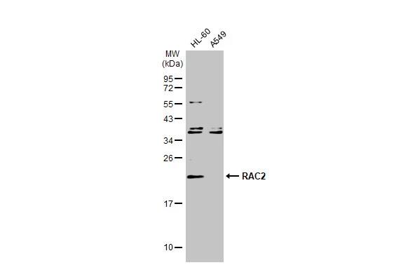 RAC2 Antibody