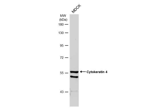 Cytokeratin 4 Antibody