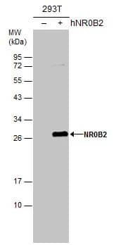 SHP/NR0B2/Nuclear Receptor SHP Antibody