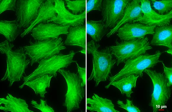 Tropomyosin-1 Antibody