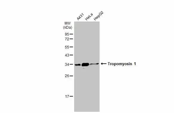 Tropomyosin-1 Antibody