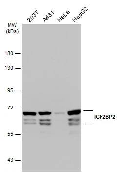 IMP2/IGF2BP2 Antibody