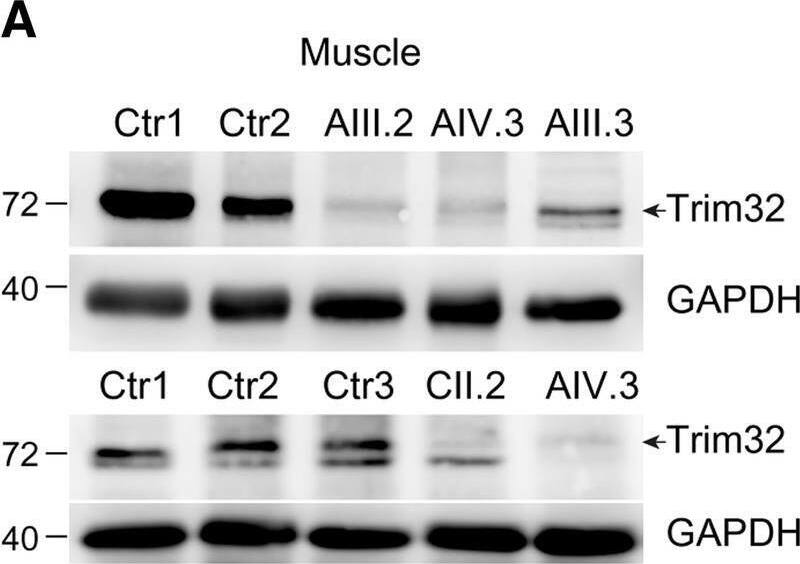 TRIM32 Antibody