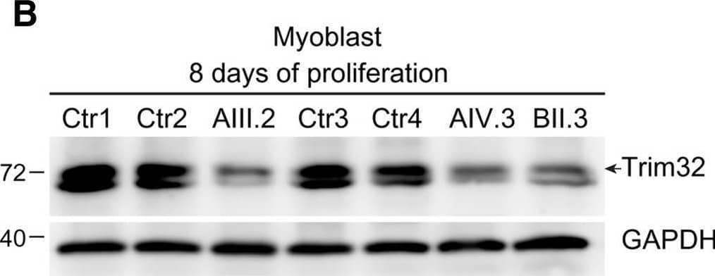 TRIM32 Antibody