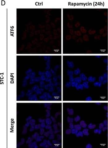ATF6 Antibody (70B1413.1) - BSA Free