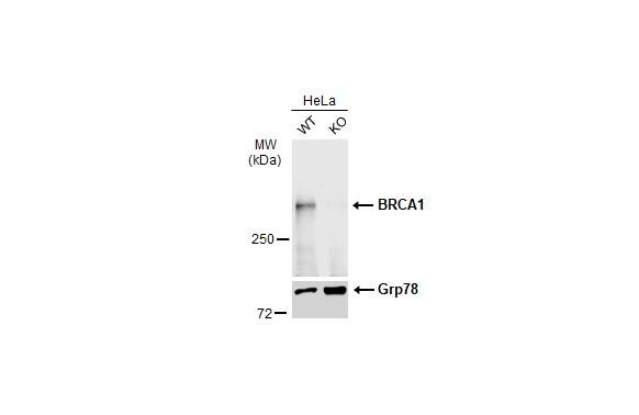 BRCA1 Antibody (17F8)