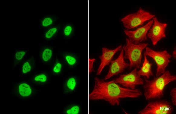 RBBP4/RbAp48 Antibody (15G12)