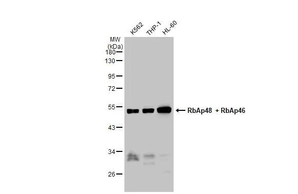 RBBP4/RbAp48 Antibody (15G12)
