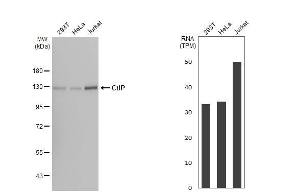 CtIP Antibody (19E8)