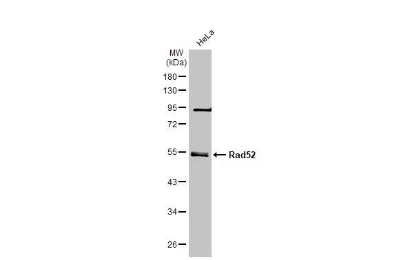 RAD52 Antibody (5H9)