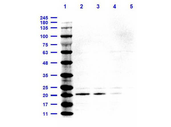 IL-6 Antibody [HRP]