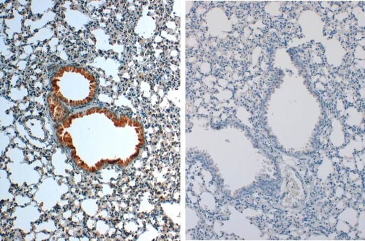 IL-1 beta/IL-1F2 Antibody