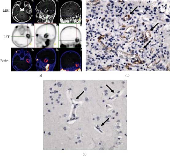 PSMA/FOLH1/NAALADase I Antibody (GCP-04) - BSA Free