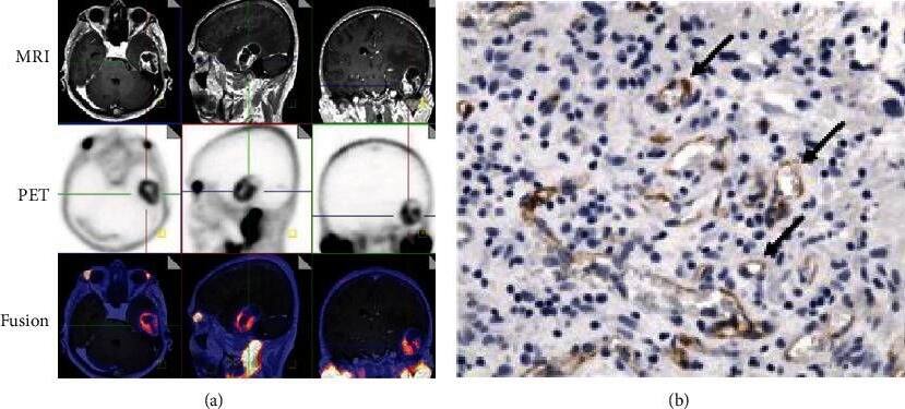 PSMA/FOLH1/NAALADase I Antibody (GCP-04) - BSA Free