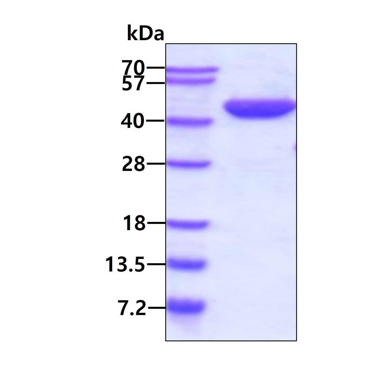 Recombinant Human Aspartate Aminotransferase His Protein