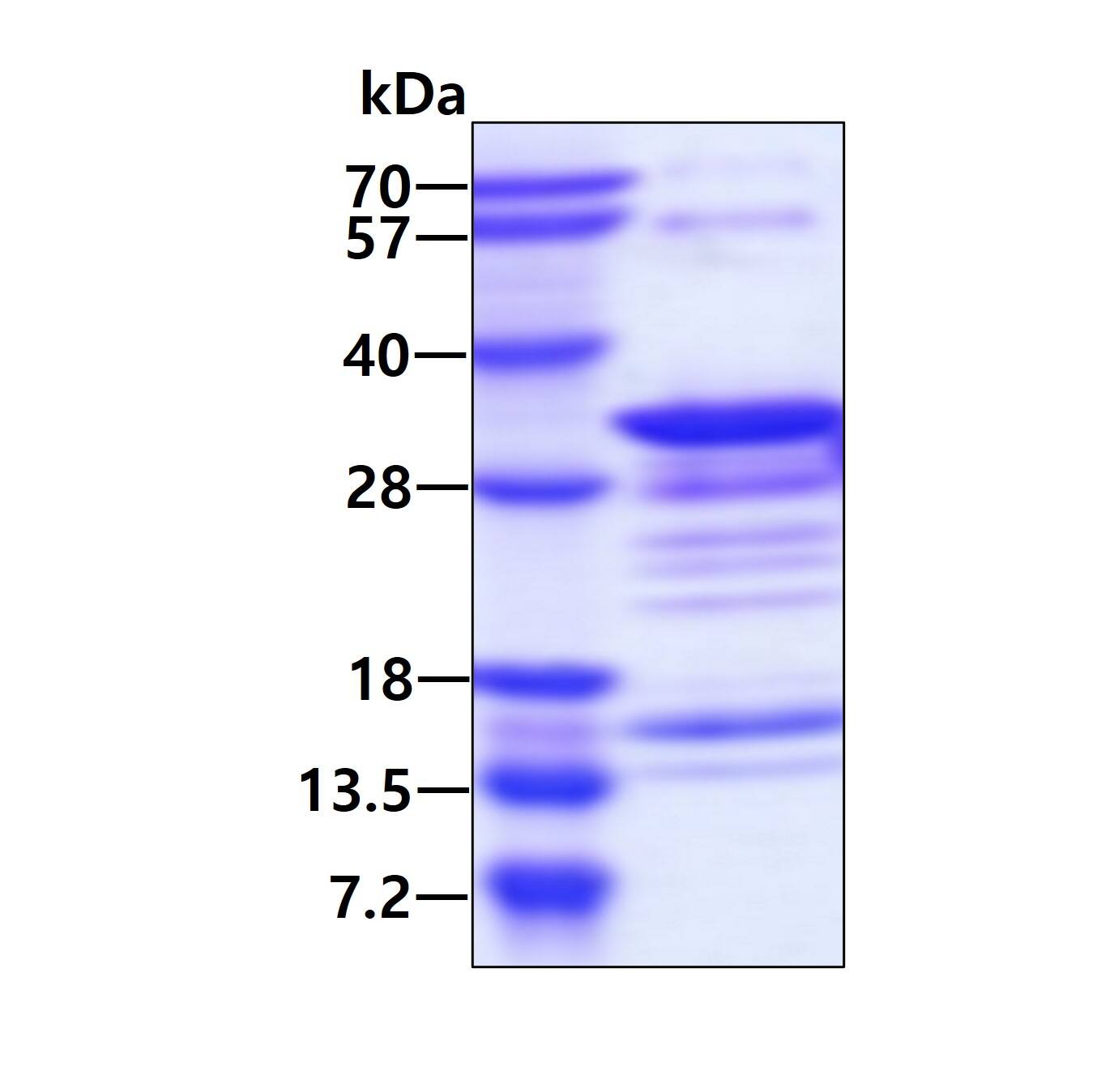 Recombinant Human WIBG His Protein