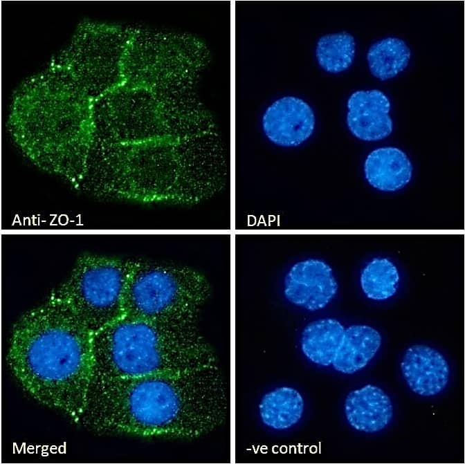 Tight Junction Protein 1 Antibody