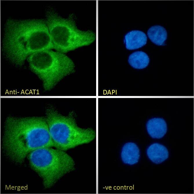 ACAT1 Antibody