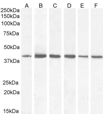 ACAT1 Antibody