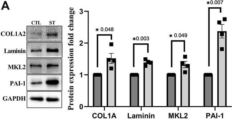 MKL2 Antibody