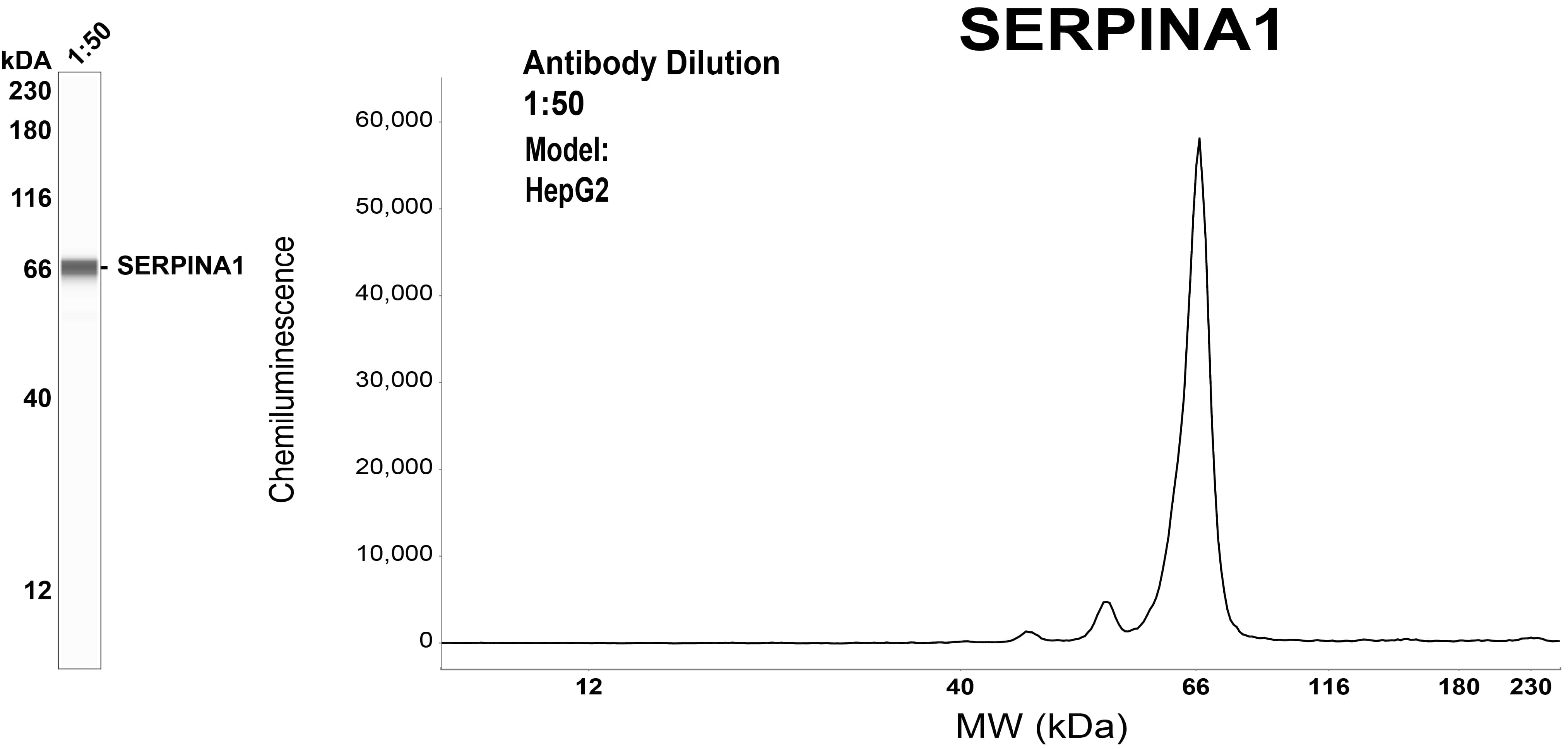Serpin A1/alpha 1-Antitrypsin Antibody (OTI9A1)