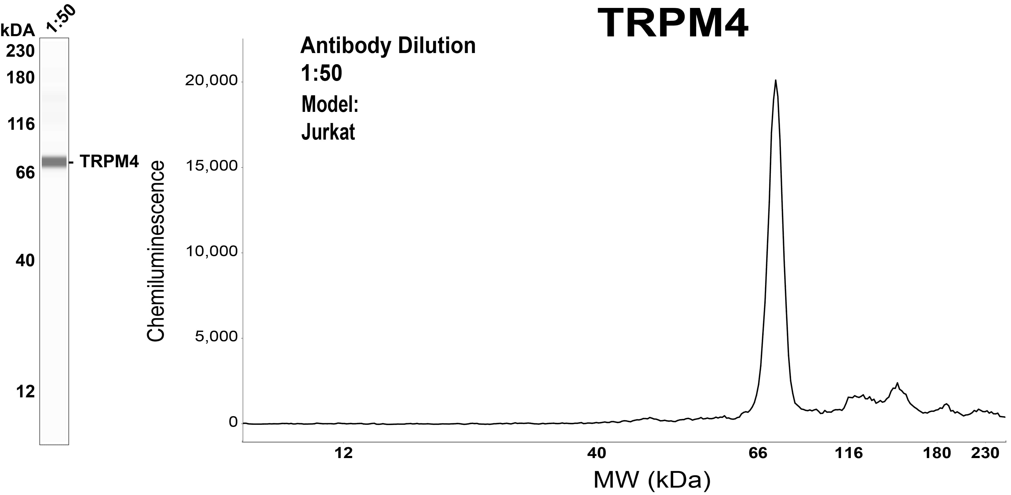 TRPM4 Antibody (OTI10H5)