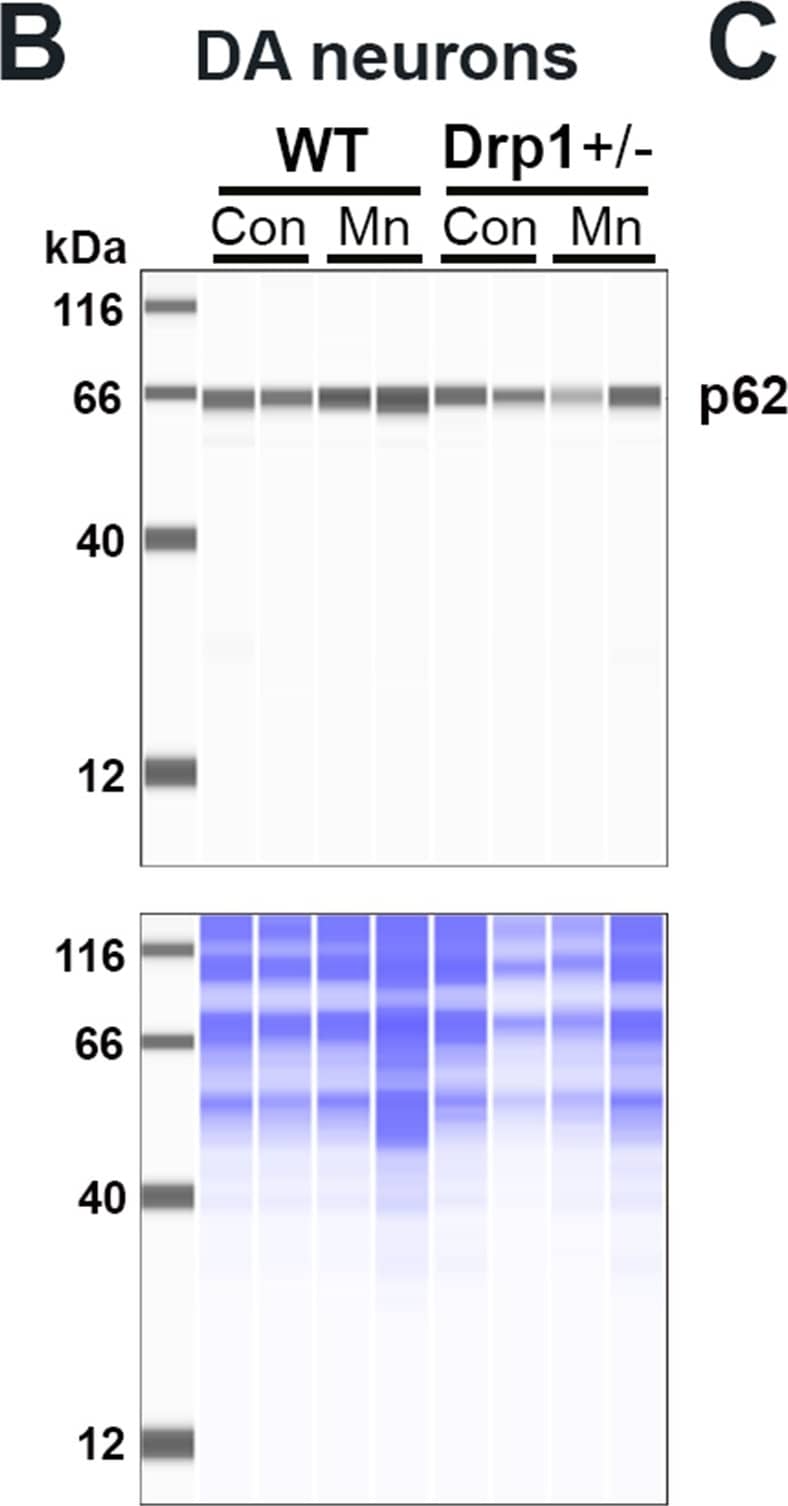 p62/SQSTM1 Antibody - BSA Free
