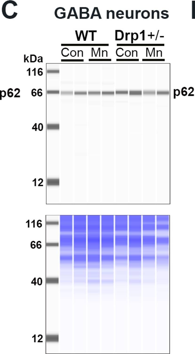 p62/SQSTM1 Antibody - BSA Free