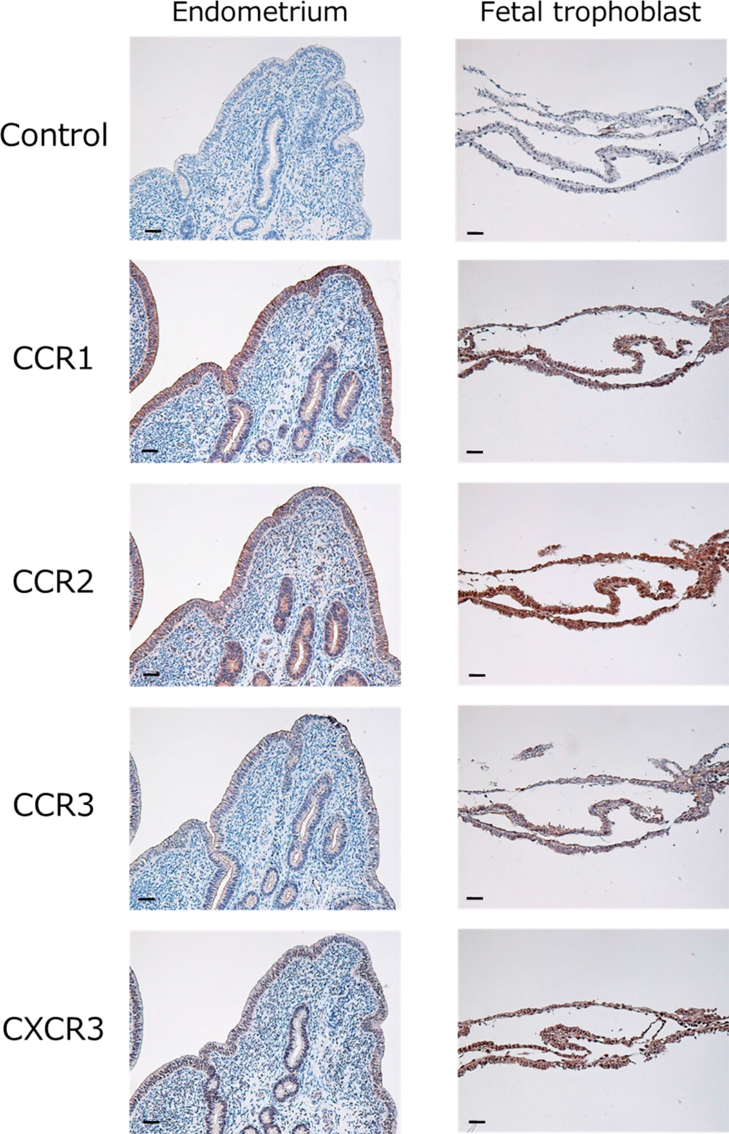 CCR2 Antibody - BSA Free