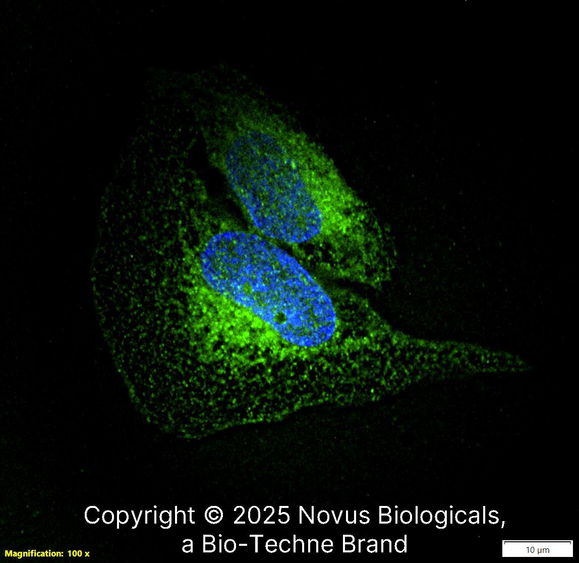 CCR2 Antibody [DyLight 488]