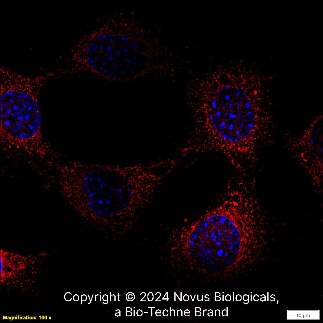 CCR2 Antibody [DyLight 550]