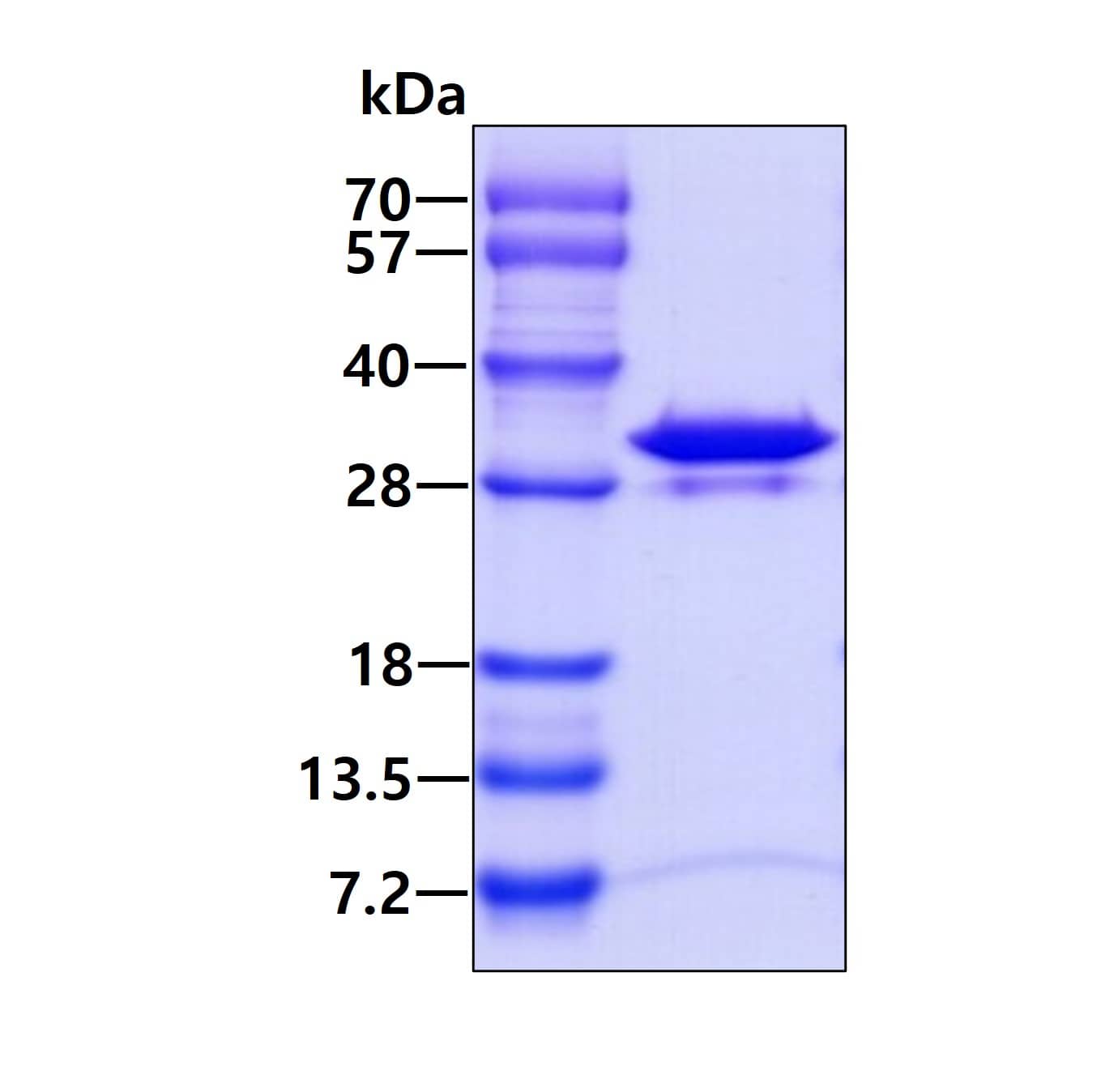 Recombinant Human PMM2/Phosphomannomutase 2 His Protein SDS-Page: Recombinant Human PMM2/Phosphomannomutase 2 His Protein [NBP1-48600]