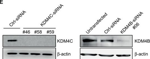 Lysine (K)-specific Demethylase 4C/KDM4C/JMJD2C Antibody - BSA Free