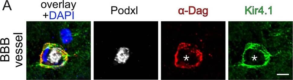 Alpha Dystroglycan Antibody (2238)