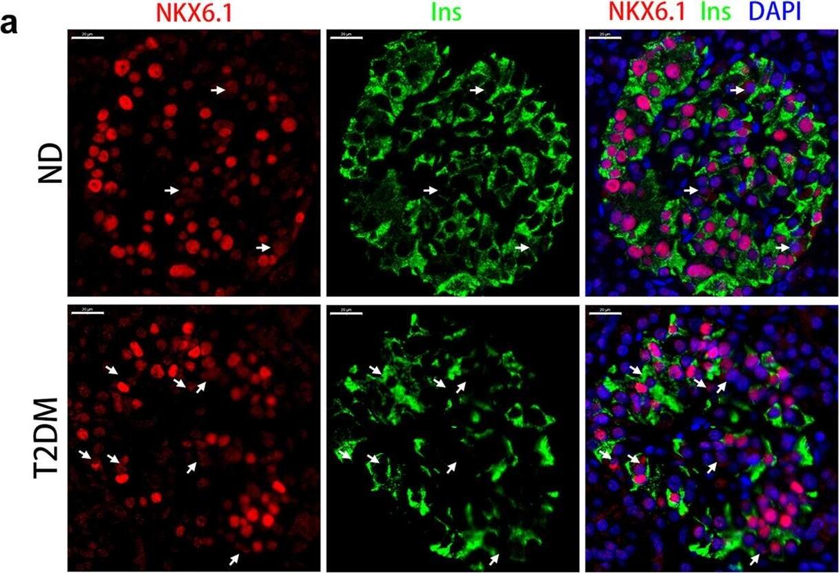 NKX6.1 Antibody - BSA Free