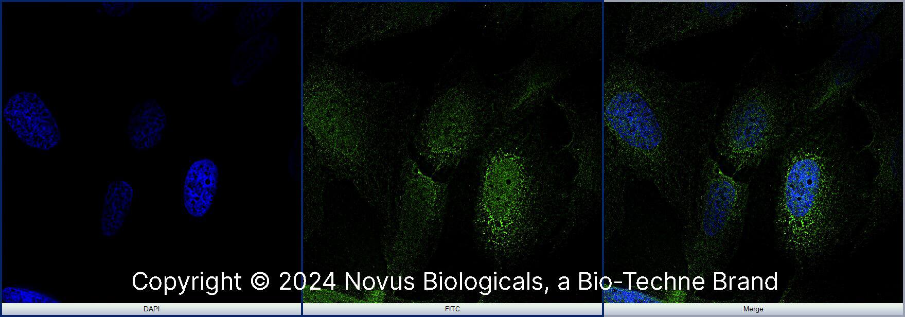 NKX6.1 Antibody [Alexa Fluor® 488]