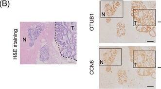 Otubain-1 Antibody